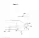 Fig. 14 - Combined laser and phacoemulsification system for eye surgery