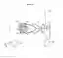 Fig. 20 - Combined laser and phacoemulsification system for eye surgery