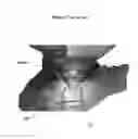 Fig. 23 - Combined laser and phacoemulsification system for eye surgery