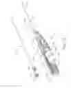Fig. 31 - Tympanostomy tube delivery device with replaceable shaft portion