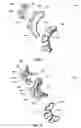Fig. 03 - RETAINING DEVICES, RETAINING DEVICES FOR USE IN RESHAPING EARS AND RELATED SYSTEMS AND METHODS
