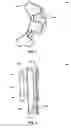 Fig. 04 - RETAINING DEVICES, RETAINING DEVICES FOR USE IN RESHAPING EARS AND RELATED SYSTEMS AND METHODS