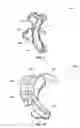 Fig. 06 - RETAINING DEVICES, RETAINING DEVICES FOR USE IN RESHAPING EARS AND RELATED SYSTEMS AND METHODS
