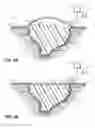 Fig. 05 - Vacuum wound therapy wound dressing with variable performance zones