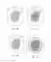 Fig. 19 - Modifiable Occlusive Skin Dressing