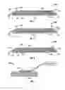 Fig. 03 - Breathable interface system for topical reduced pressure