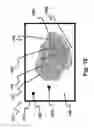 Fig. 17 - Vision measurement and training system and method of operation thereof