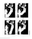 Fig. 03 - METHODS AND DEVICES FOR FLEXURAL ADULT DEVICES