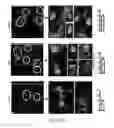 Fig. 12 - Edible plant-derived microvesicle compositions including conjugated therapeutic agents and methods for using the same