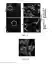 Fig. 14 - Edible plant-derived microvesicle compositions including conjugated therapeutic agents and methods for using the same
