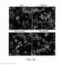 Fig. 15 - Edible plant-derived microvesicle compositions including conjugated therapeutic agents and methods for using the same