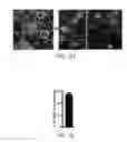 Fig. 18 - Edible plant-derived microvesicle compositions including conjugated therapeutic agents and methods for using the same