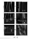 Fig. 43 - Edible plant-derived microvesicle compositions including conjugated therapeutic agents and methods for using the same