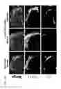 Fig. 08 - COMPOSITIONS AND METHODS FOR TREATING NEUROPATHY