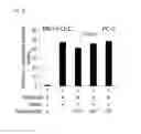 Fig. 04 - Minoxidil for suppressing androgen receptor function