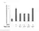 Fig. 06 - Minoxidil for suppressing androgen receptor function