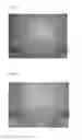 Fig. 11 - Minoxidil for suppressing androgen receptor function