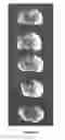 Fig. 02 - Pharmaceutical Compositions Containing Palmitoylethanolamide And Cytidine-Diphosphocholine And Methods Of Treatment Therewith