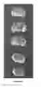 Fig. 03 - Pharmaceutical Compositions Containing Palmitoylethanolamide And Cytidine-Diphosphocholine And Methods Of Treatment Therewith