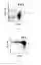 Fig. 03 - Method for treating cancers with dendritic killer cells and pharmaceutical composition comprising the same