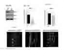 Fig. 07 - Inhibition of choroidal neovascularization