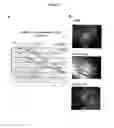 Fig. 09 - Method of expanding double negative T cells