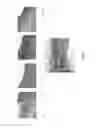 Fig. 02 - METHOD AND COMPOSITION FOR TREATING INFLAMMATORY BOWEL DISEASE WITHOUT COLECTOMY