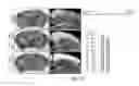 Fig. 38 - Osteocalcin as a treatment for cognitive disorders