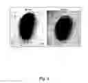 Fig. 06 - Attenuated strains