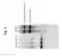 Fig. 06 - Compositions and methods for the treatment or prevention of human immunodeficiency virus infection