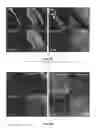 Fig. 31 - Devices, systems and methods for optogenetic modulation of action potentials in target cells