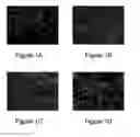 Fig. 02 - Cell sheet construct for neurovascular reconstruction and manufacture thereof