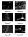 Fig. 03 - Cell sheet construct for neurovascular reconstruction and manufacture thereof