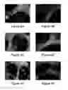 Fig. 05 - Cell sheet construct for neurovascular reconstruction and manufacture thereof