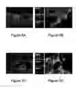 Fig. 06 - Cell sheet construct for neurovascular reconstruction and manufacture thereof