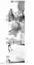 Fig. 02 - Bioengineered allogeneic blood vessel