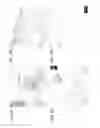 Fig. 04 - Bioengineered allogeneic blood vessel