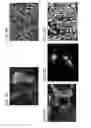 Fig. 07 - Bioengineered allogeneic blood vessel