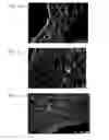 Fig. 10 - Bioengineered allogeneic blood vessel