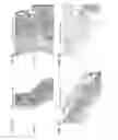 Fig. 17 - Bioengineered allogeneic blood vessel