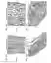 Fig. 18 - Bioengineered allogeneic blood vessel
