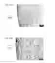 Fig. 29 - Bioengineered allogeneic blood vessel
