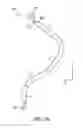 Fig. 03 - Anatomic fit of a percutaneous VAD for right heart support