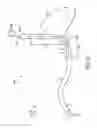 Fig. 05 - Anatomic fit of a percutaneous VAD for right heart support