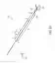 Fig. 06 - Anatomic fit of a percutaneous VAD for right heart support
