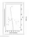 Fig. 11 - Anatomic fit of a percutaneous VAD for right heart support