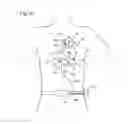 Fig. 15 - Left ventricular cardiac assist pump and methods therefor