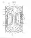 Fig. 16 - Left ventricular cardiac assist pump and methods therefor