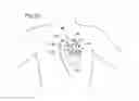Fig. 19 - Left ventricular cardiac assist pump and methods therefor