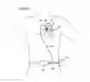 Fig. 20 - Left ventricular cardiac assist pump and methods therefor